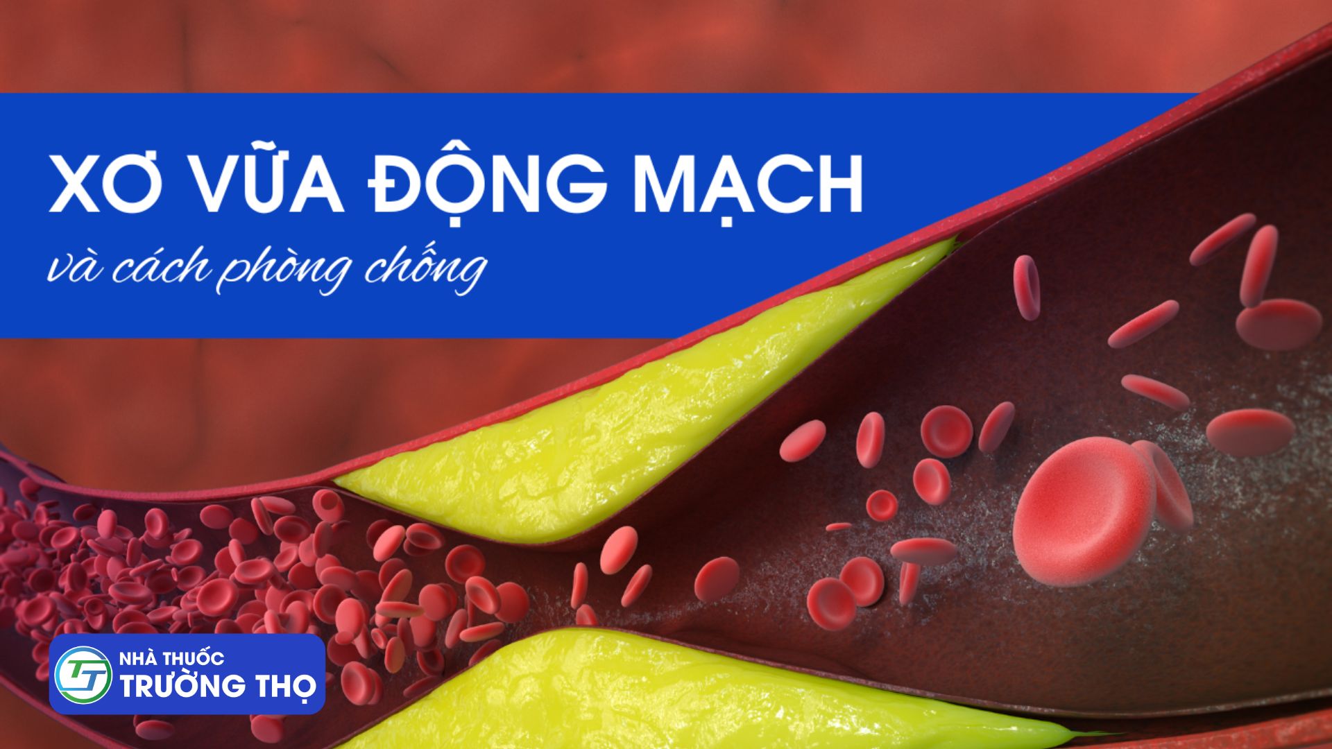 Trường Thọ - roi loan tien dinh 4