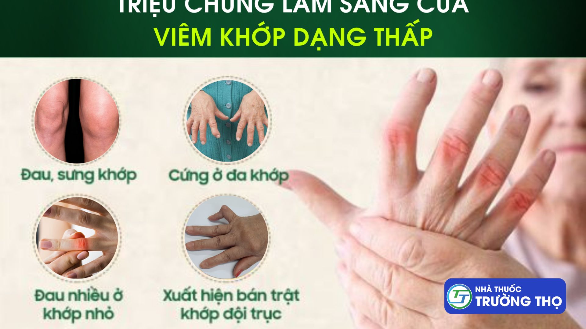 Triệu chứng điển hình của viêm khớp dạng thấp