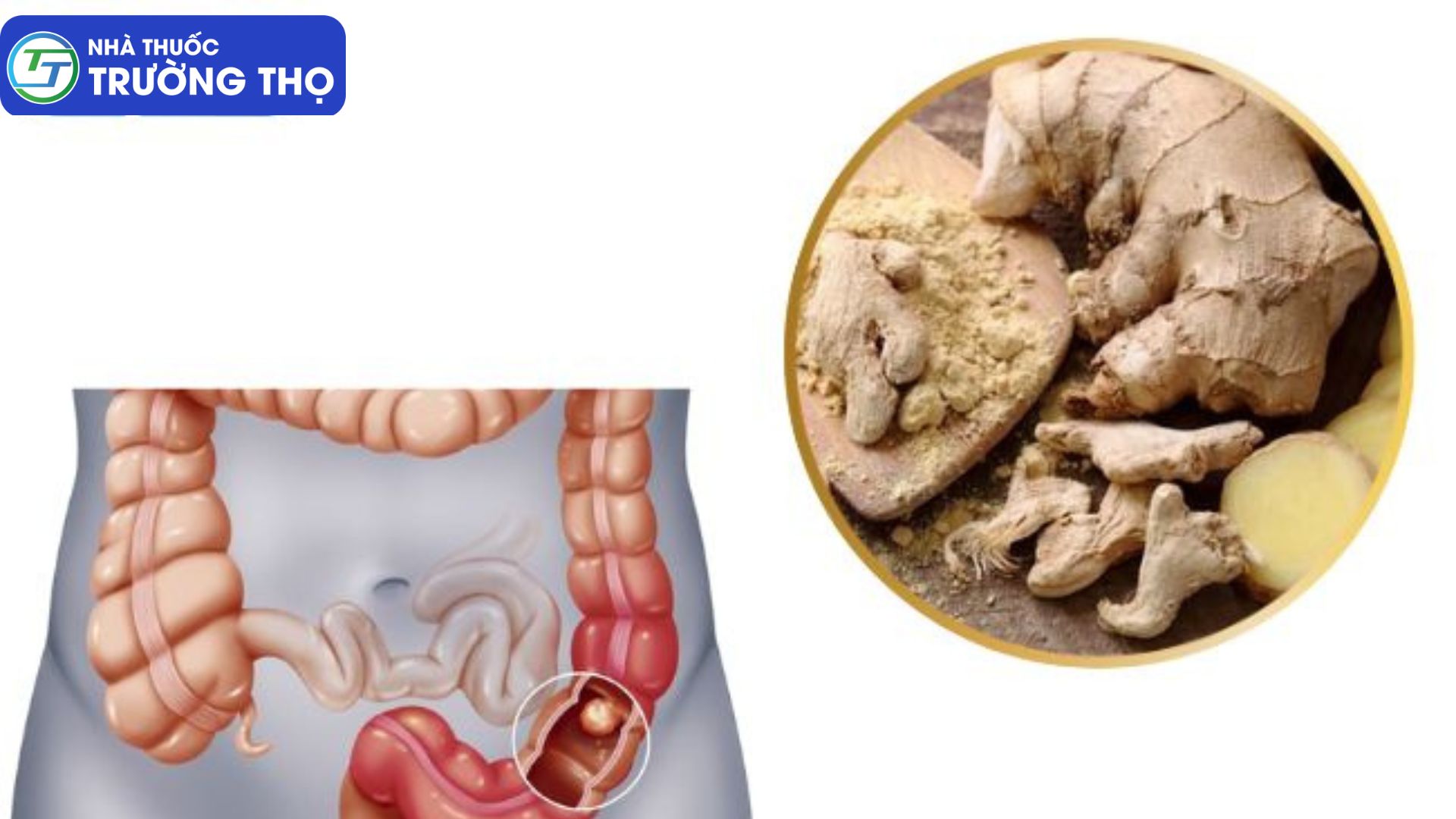 Can khương chống co thắt đại tràng, kháng viêm, diệt khuẩn tốt