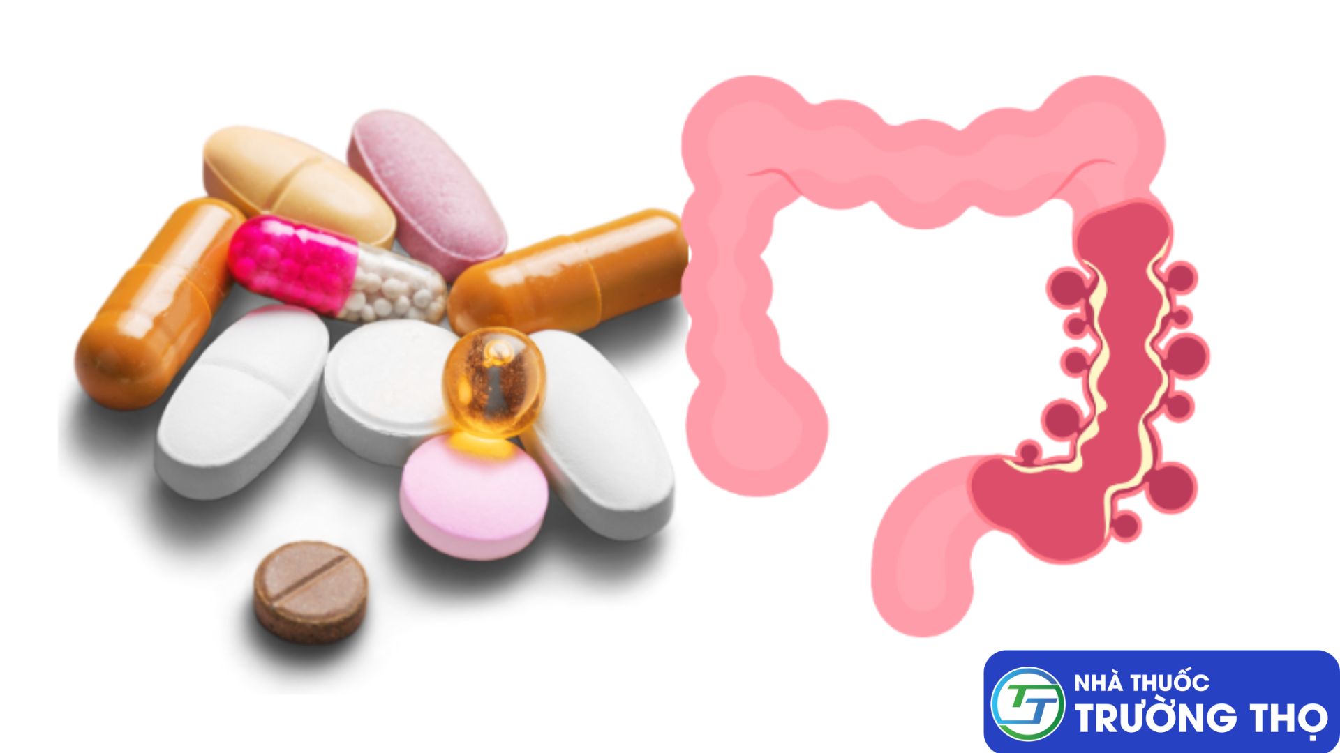 Sử dụng thuốc dành riêng để điều trị hội chứng ruột kích thích