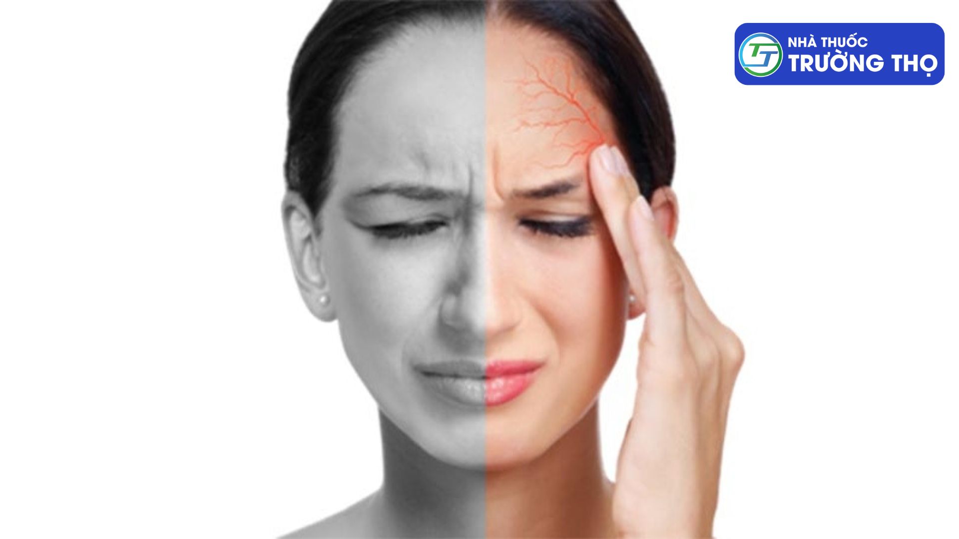 Đau nửa đầu là tình trạng một bên đầu xuất hiện cảm giác đau